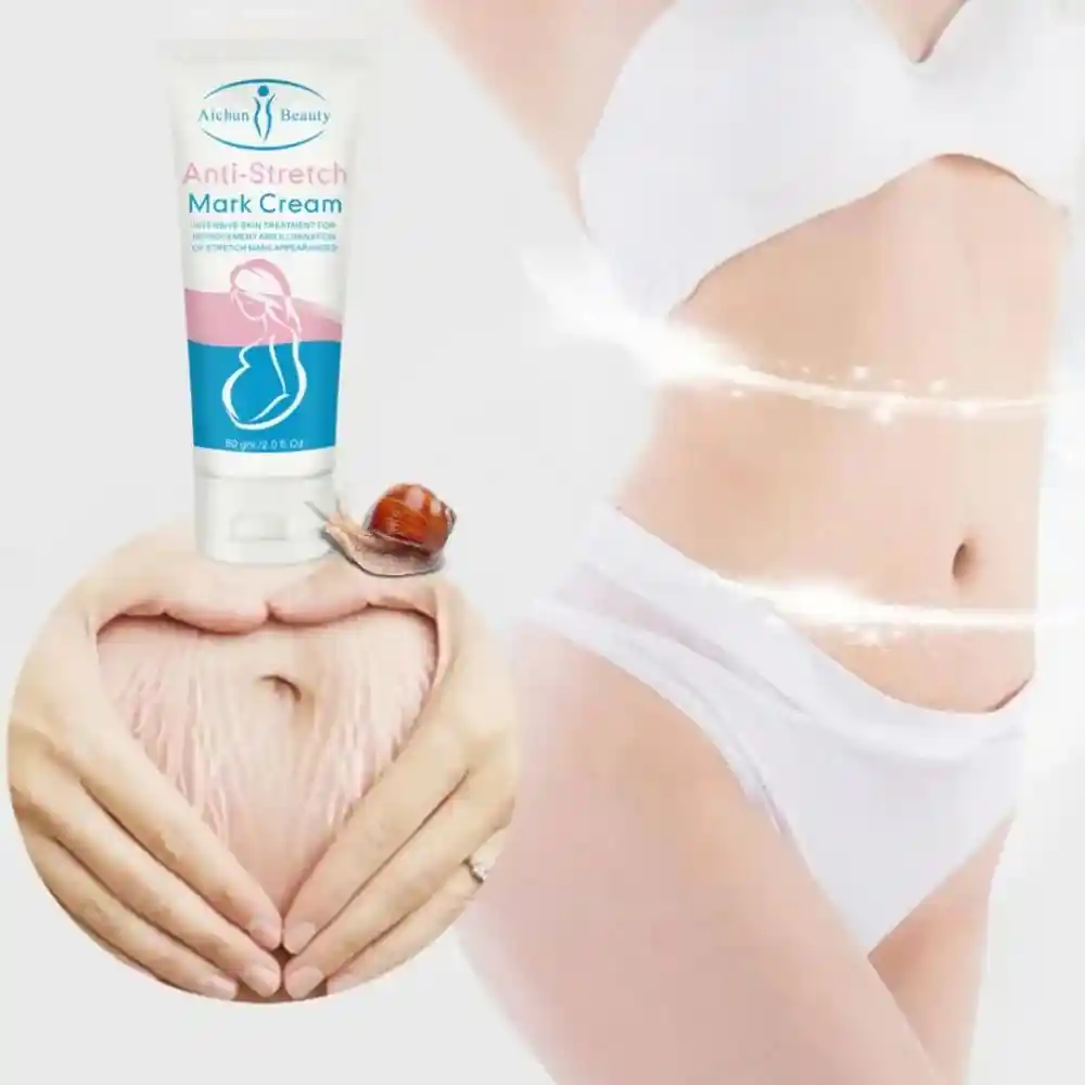 Anti-Stretch-Mark-Cream-60gm
