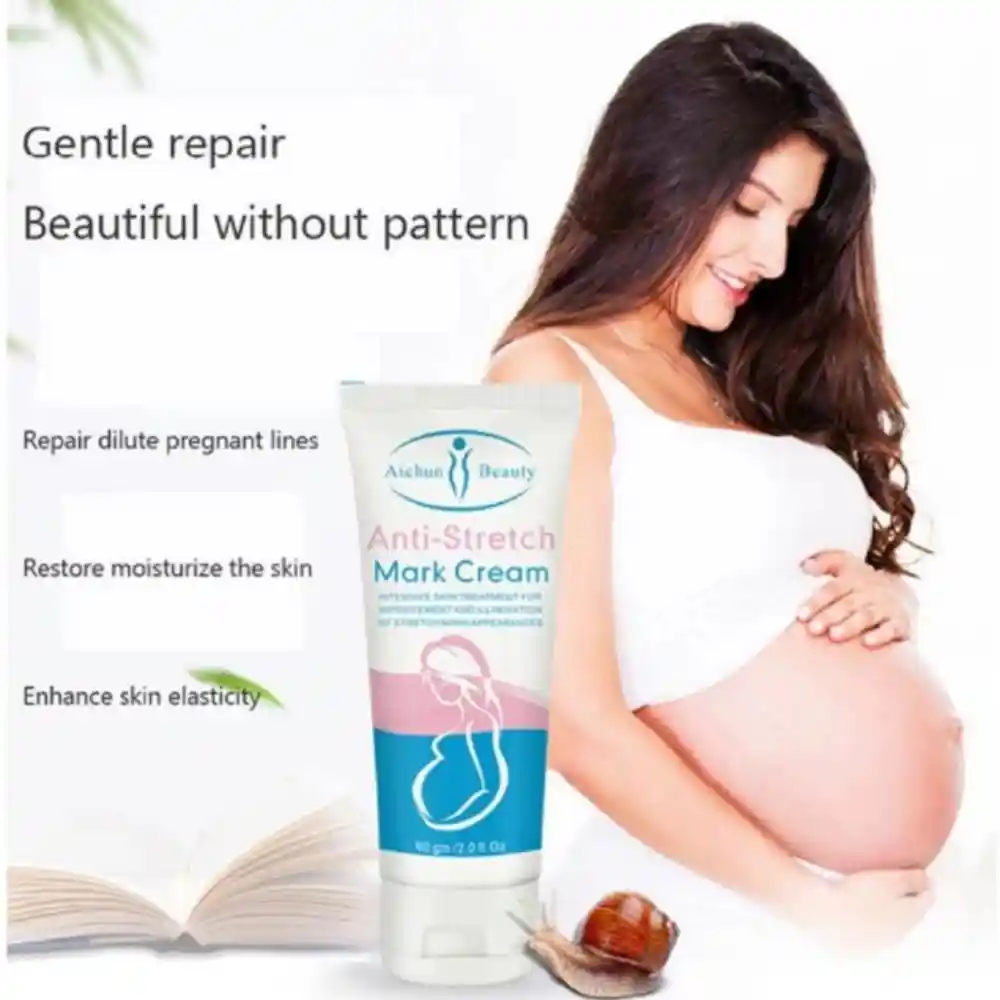 best stretch mark removal creamu200b