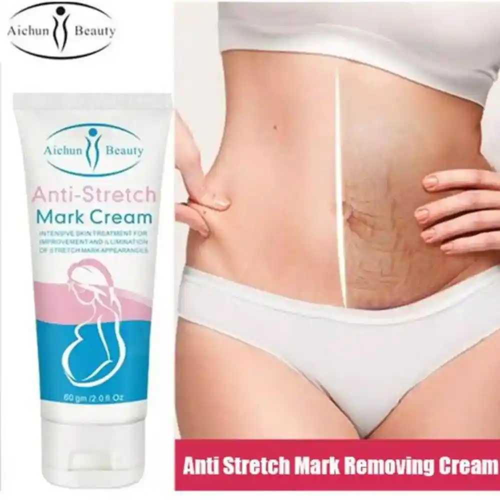mederma stretch mark creamu200b