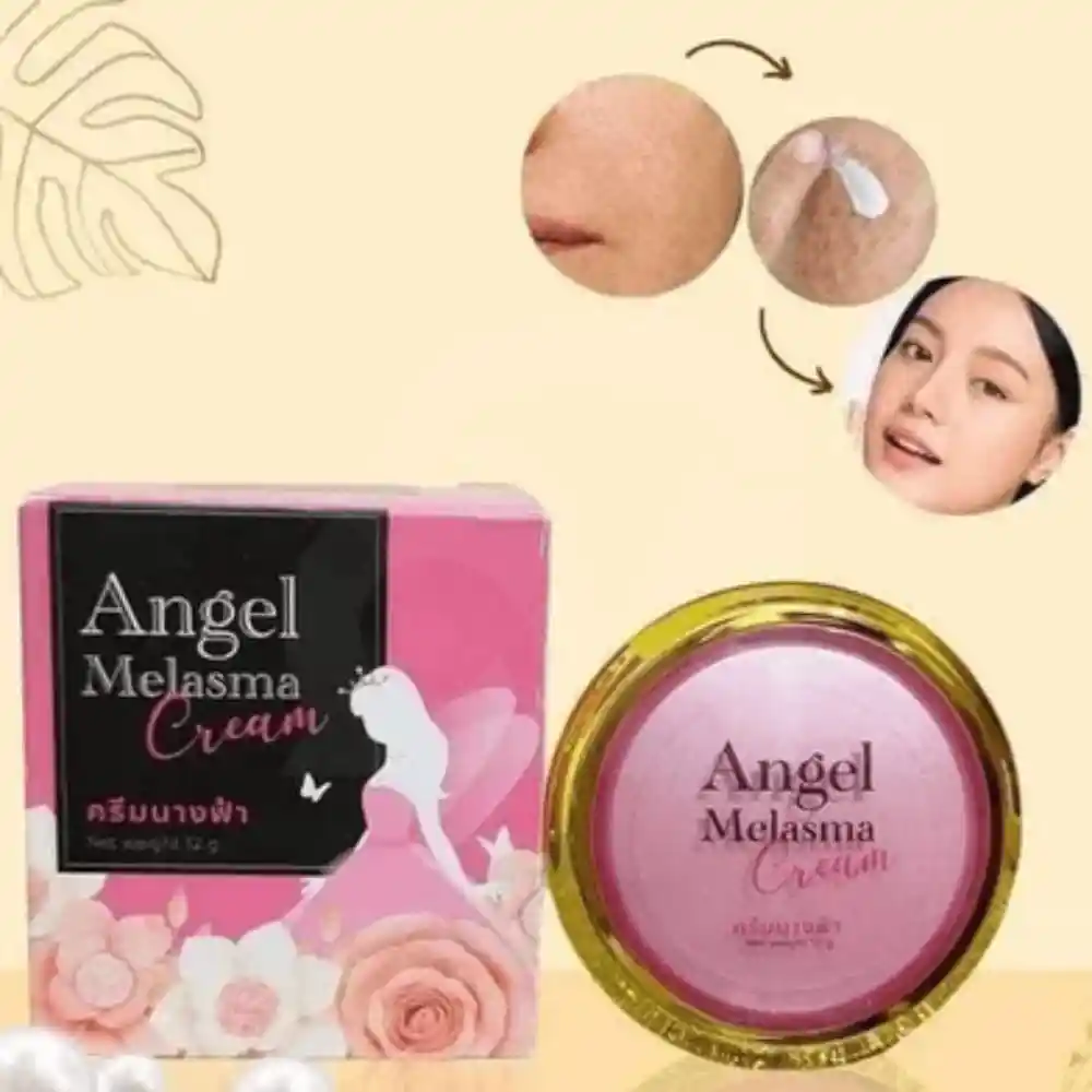 best cream for melasmau200b