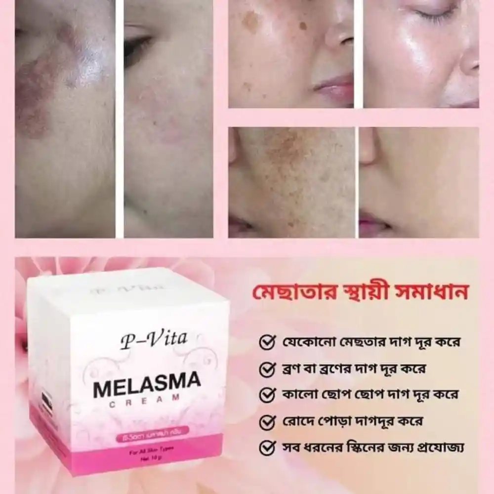 best melasma cream price in bangladesh