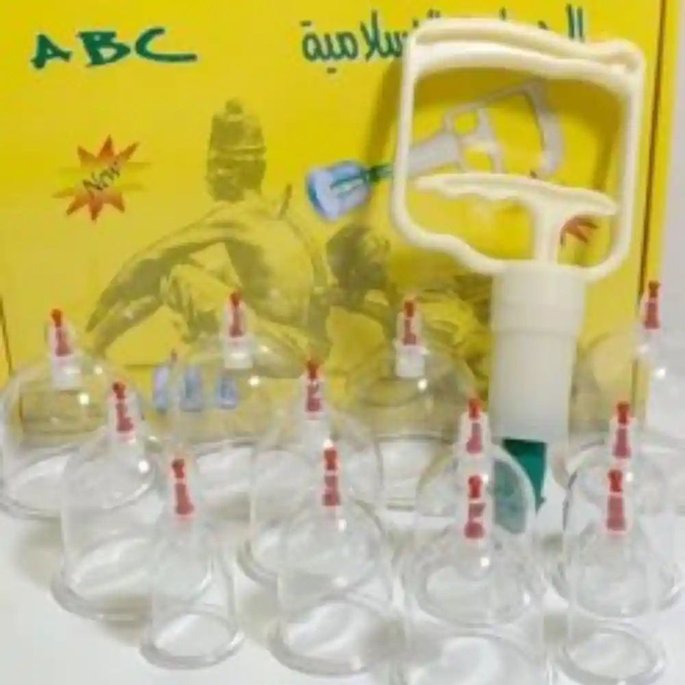 vacuum cupping setu200b